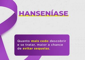 Janeiro Roxo: Saiba como se prevenir contra a Hanseníase