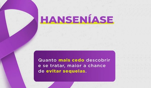 Janeiro Roxo: Saiba como se prevenir contra a Hanseníase