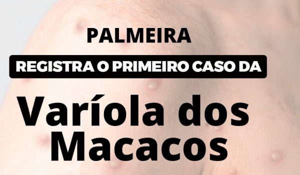 Palmeira registra o primeiro caso da Varíola dos Macacos